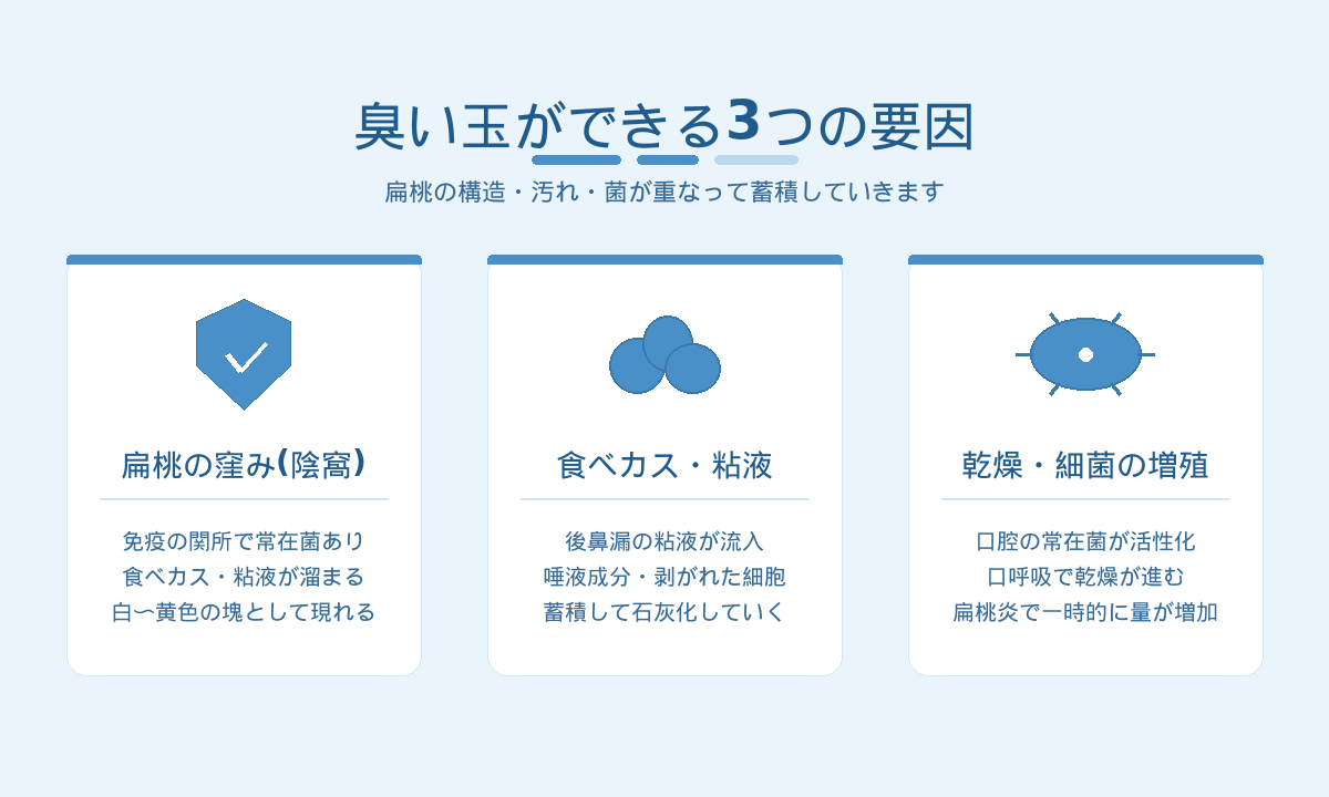 臭い玉ができる3つの要因｜扁桃の窪み（陰窩）・食べカス/粘液・乾燥と細菌の蓄積