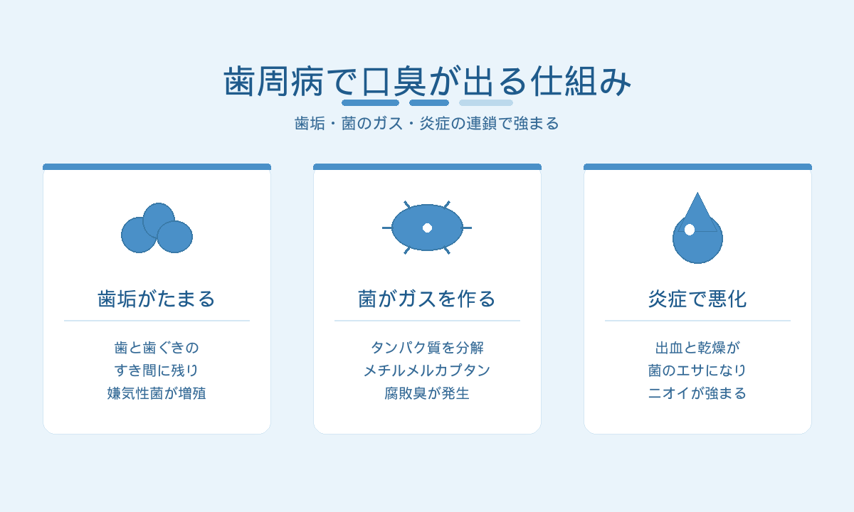 歯周病で口臭が出る仕組み｜歯垢・嫌気性菌・メチルメルカプタン・炎症の悪循環