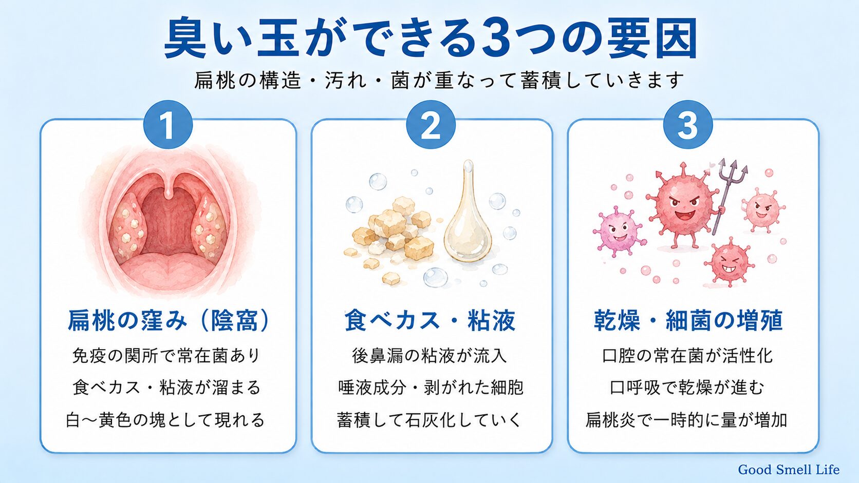 臭い玉ができる3つの要因｜扁桃の窪み（陰窩）・食べカス/粘液・乾燥と細菌の蓄積